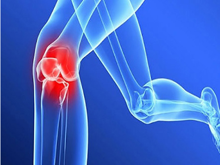 骨關節炎的病因_導致骨性關節炎的常見原因有哪些？